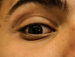 The human eye socket is a swirl of curves, a mini universe with a dark sun at its center.
